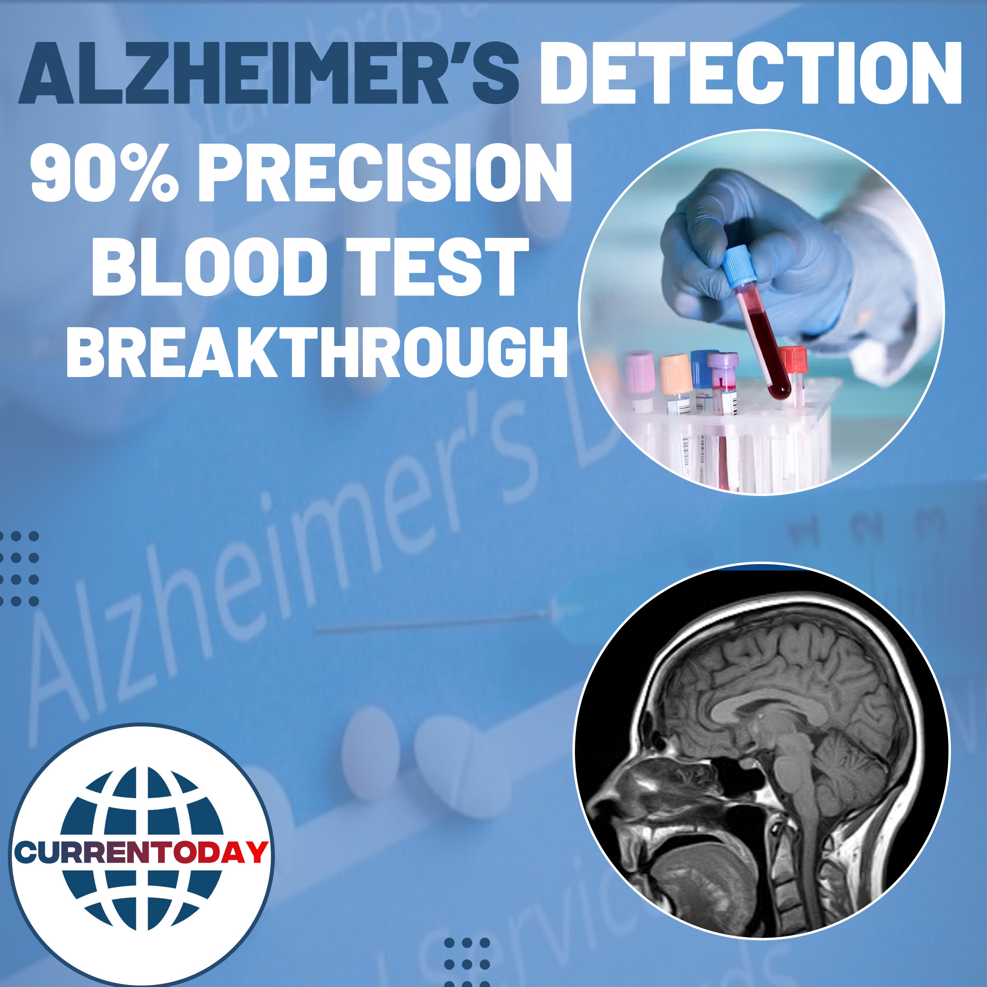 Alzheimer's Detection: 90% Precision Blood Test Breakthrough